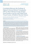 Research paper thumbnail of Correlation Between the Findings of Optical Coherent Retinal Tomography (OCT), Stereo Biomicroscopic Images from Fundus of an Eye and Values from Visual Acuity of Diabetic Macular Edema