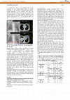 Research paper thumbnail of PO-0966: Audiovisual biofeedback breathing training during thoracic 4DCT imaging: a digital phantom study