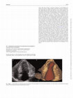 Research paper thumbnail of 813 The added value of transthoracic three dimensional echocardiography in apical hypertrophic cardiomyopathy