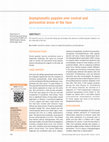 Research paper thumbnail of Asymptomatic papules over central and pericentral areas of the face