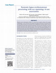 Research paper thumbnail of Systemic lupus erythematosus presenting with eye squinting: A rare association