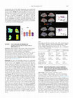 Research paper thumbnail of Receiver Operating Characteristics (Roc) of Flow and Amyloid Load Indices from Brain Maps of [11C]PIB Retention in Alzheimer's Disease