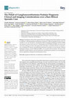 Research paper thumbnail of The Pitfall of Ganglioneuroblastoma-Nodular Diagnosis: Clinical and Imaging Considerations over a Rare Bifocal Sporadic Case