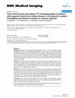 Research paper thumbnail of Three-dimensional drip infusion CT cholangiography in patients with suspected obstructive biliary disease: A retrospective analysis of feasibility and adverse reaction to contrast material