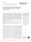 Research paper thumbnail of Use of a bioartificial dermal regeneration template for skin restoration in combat casualty injuries