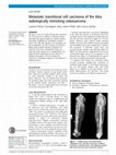 Research paper thumbnail of Metastatic transitional cell carcinoma of the tibia radiologically mimicking osteosarcoma