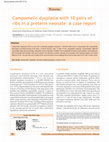 Research paper thumbnail of Campomelic dysplasia with 10 pairs of ribs in a preterm neonate: A case report