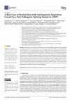 Research paper thumbnail of A Rare Case of Brachyolmia with Amelogenesis Imperfecta Caused by a New Pathogenic Splicing Variant in LTBP3