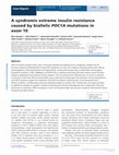 Research paper thumbnail of A syndromic extreme insulin resistance caused by biallelic POC1A mutations in exon 10