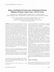 Research paper thumbnail of Biopsy and radical prostatectomy pathological patterns influence Prostate cancer gene 3 (PCA3) score