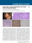 Research paper thumbnail of Colonic polyp in a HIV-positive patient: an unexpected diagnosis