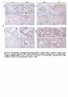 Research paper thumbnail of Figure S3 from The Autotaxin—Lysophosphatidic Acid Axis Promotes Lung Carcinogenesis