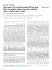 Research paper thumbnail of Open surgery for ventricular tachycardia following failed stereotactic radiation treatment: A bailout when a parachute hasn’t helped