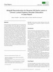 Research paper thumbnail of Allograft Reconstruction for Reverse Hill-Sachs Lesion in Chronic Locked Posterior Shoulder Dislocation: A Case Report