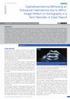 Research paper thumbnail of Cephalhaematoma Mimicking an Extradural Haematoma due to MirrorImage Artifact on Sonography in a Term Neonate: A Case Report