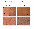 Research paper thumbnail of Supplementary Figure 1 from Transforming Growth Factor-β1 and CD105 Promote the Migration of Hepatocellular Carcinoma–Derived Endothelium