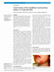 Research paper thumbnail of Crown fracture of the mandibular second primary molars in a 4-year-old child