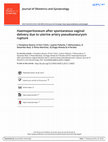 Research paper thumbnail of Haemoperitoneum after spontaneous vaginal delivery due to uterine artery pseudoaneurysm rupture