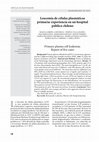 Research paper thumbnail of Leucemia de células plasmáticas primaria: experiencia en un hospital público chileno