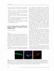 Research paper thumbnail of Is the increased presence of cd8 t-lymphocytes related to serotonin levels in chagas' disease?