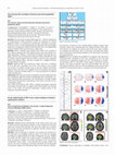 Research paper thumbnail of O15: Source localisation of rhythmic ictal activity: a study of diagnostic accuracy following STARD criteria