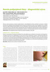 Research paper thumbnail of Sublingual ranula - a diagnostic challenge