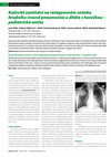 Research paper thumbnail of Kulovité zastínění na rentgenovém snímku hrudníku (round pneumonia) u dítěte s horečkou - pediatrická entita