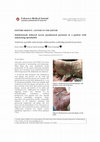 Research paper thumbnail of Adalimumab induced severe paradoxical psoriasis in a patient with ankylosing spondylitis