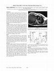 Research paper thumbnail of Human Cardiac MRI at 3 Tesla Using a Whole Body Radio Frequency Coil