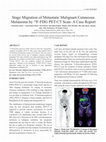 Research paper thumbnail of Stage Migration of Metastatic Malignant Cutaneous Melanoma by 18F-FDG PET-CT Scan- A Case Report