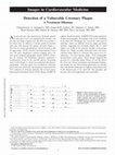 Research paper thumbnail of Detection of a Vulnerable Coronary Plaque