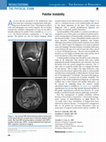 Research paper thumbnail of Patellar Instability