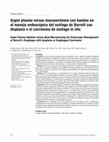 Research paper thumbnail of Argón plasma versus mucosectomía con bandas en el manejo endoscópico del esófago de Barrett con displasia o el carcinoma de esófago in situ