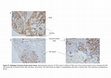 Research paper thumbnail of Supplementary Fig. 7 from Hypoxia Attenuates Trastuzumab Uptake and Trastuzumab-Emtansine (T-DM1) Cytotoxicity through Redistribution of Phosphorylated Caveolin-1