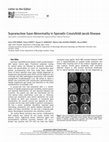 Research paper thumbnail of Sporadik Creutzfeldt-Jacob Hastalığında Supranükleer Bakış Parezisi