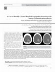 Research paper thumbnail of A Case of Possible Cerebral Amyloid Angiopathy Presenting with Diffuse Cerebellar Hemosiderosis