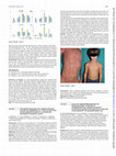 Research paper thumbnail of AB1087 Prolonged response with tumour necrosis factor alfa inhibition in a 5 year old boy with severe manifestations of il-36 receptor antagonist deficiency (DITRA)