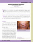 Research paper thumbnail of Granuloma dermatofítico degenerativo