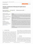 Research paper thumbnail of Valvular complications following the Impella device implantation