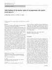 Research paper thumbnail of MRI findings in the lumbar spines of asymptomatic elite junior tennis players