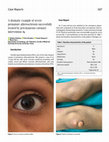 Research paper thumbnail of A dramatic example of severe premature atherosclerosis successfully treated by percutaneous coronary intervention