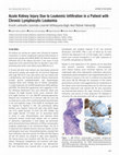 Research paper thumbnail of Acute Kidney Injury Due to Leukemic Infiltration in a Patient with Chronic Lymphocytic Leukemia