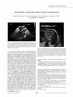 Research paper thumbnail of Symptomatic intracardiac diffuse large B-cell lymphoma