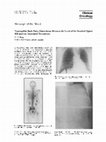 Research paper thumbnail of Neuropathic back pain: Discordance between the level of the involved spine/rib and the associated dermatome