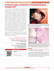 Research paper thumbnail of Juxtaoral organ of Chievitz: A histopathological masquerade