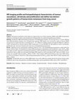 Research paper thumbnail of MR imaging profile and histopathological characteristics of tumour vasculature, cell density and proliferation rate define two distinct growth patterns of human brain metastases from lung cancer