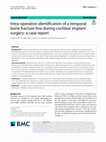 Research paper thumbnail of Intra-operative identification of a temporal bone fracture line during cochlear implant surgery: a case report