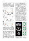 Research paper thumbnail of EP-1562: VMAT pre-treatment verification using Octavius 4D system: from simple to more complex plans