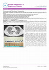 Research paper thumbnail of Extracorporeal Membrane Oxygenation