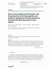 Research paper thumbnail of Severe Toxic Epidermal Necrolysis and Drug Reaction with Eosinophilia and Systemic Symptoms Overlap Syndrome Treated with Benralizumab: A Case Report